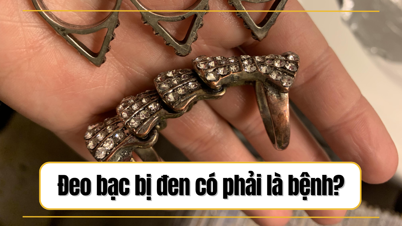 Vì sao đeo bạc bị đen? Đeo bạc bị đen có phải bệnh không?