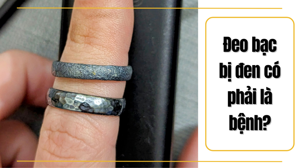 Vậy đeo bạc bị đen có phải bệnh không?