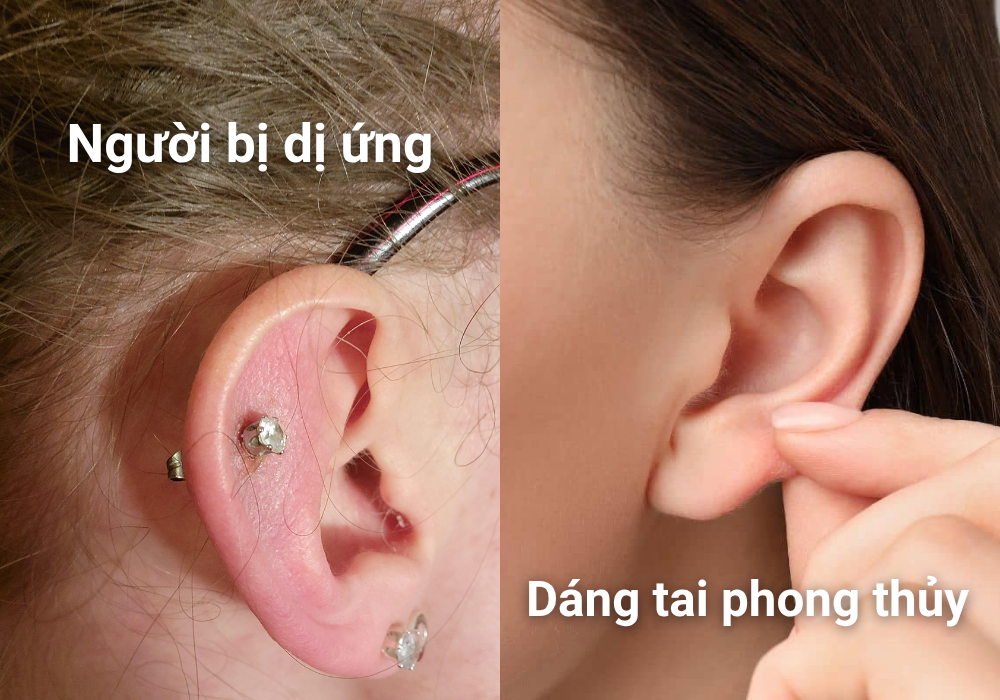 Bấm lỗ tai có đau không? Bấm lỗ tai bao lâu thì lành? 7 Ai không nên bấm lỗ tai